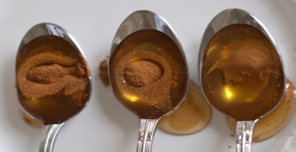 Cinnamon and Honey: Most Powerful Remedy That Not Even Doctors Can Explain